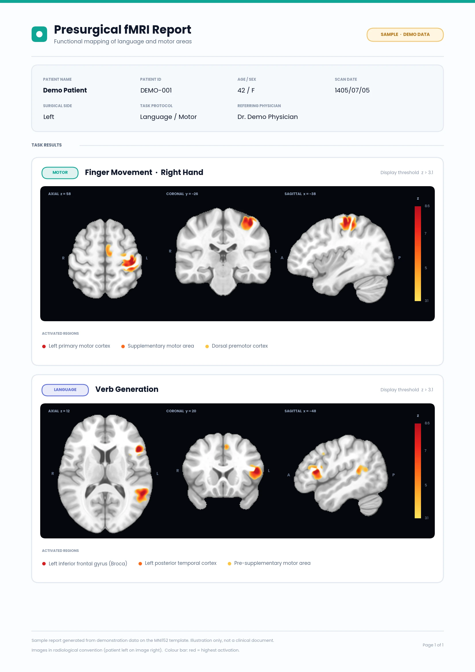 صفحهٔ اول یک گزارش نمونهٔ fMRI با نوار اطلاعات بیمار نمایشی و تصاویر فعالیت یک تسک حرکتی و یک تسک زبانی