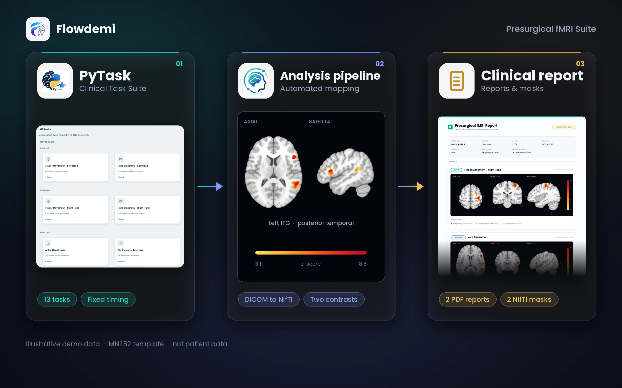 مسیر کامل مجموعه fMRI پیش از جراحی: نرم‌افزار PyTask، پایپ‌لاین تحلیل و گزارش نهایی، در سه مرحلهٔ پیوسته